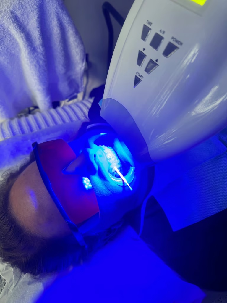 Teeth Whitening Treatment
